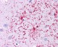 GLUD1 antibody - N-terminal region